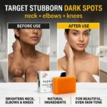 Kojic Acid Soap - Removing stubborn dark spots on the skin of the neck, elbows, and knees - ত্বকে ঘাড়, কনুই, হাঁটুতে জেদি কালো দাগ দূরীকরণ From Skinzo Bd