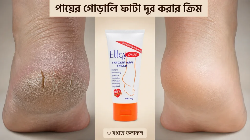 পায়ের গোড়ালি ফাটা দূর করার ক্রিম