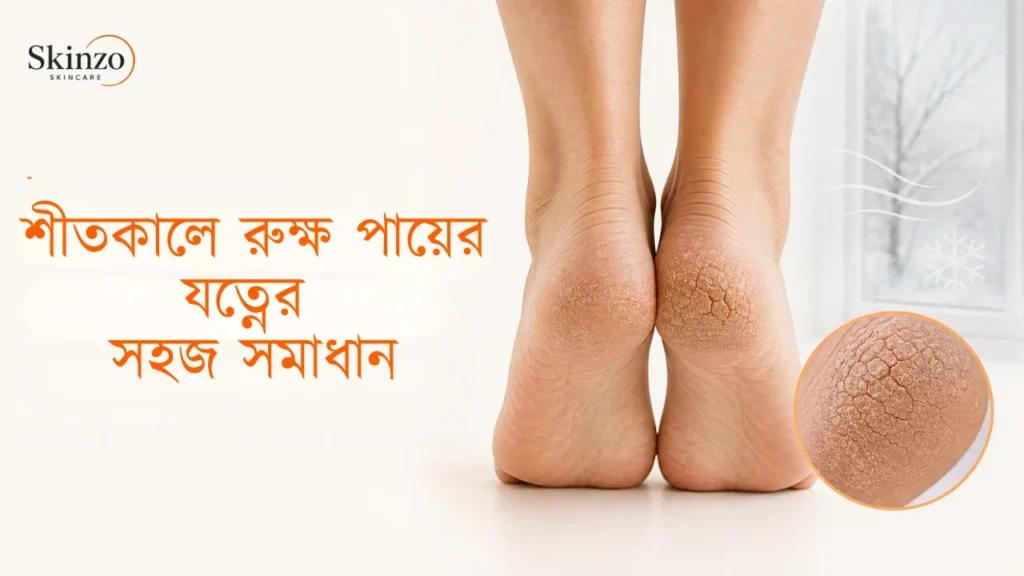 শীতকালে রুক্ষ পায়ের যত্ন - পা ফাটা ও শক্ত গোড়ালি নরম রাখার সহজ উপায়